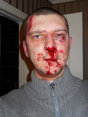 Сергей Вилков после нападения на него 13 января 2014 г. (фото с личной страницы Сергея в Facebook)