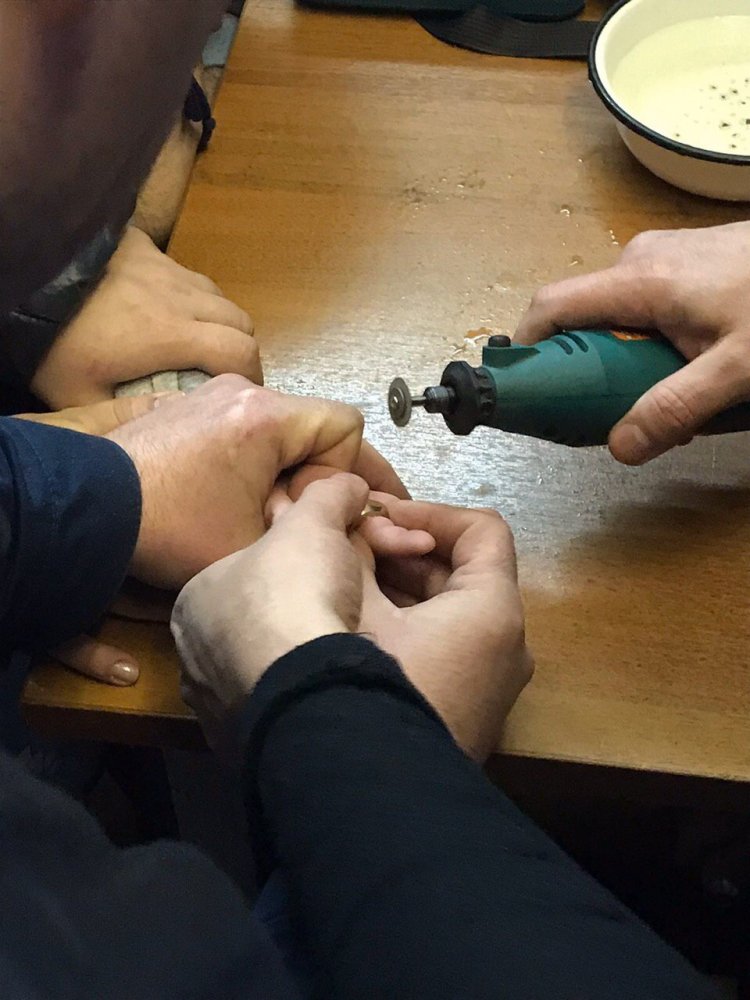 Спасатели снимают гайку с пальца ребенка