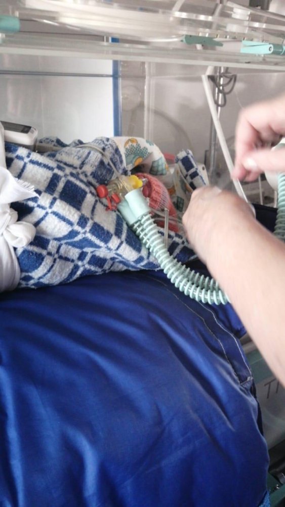 В Саратов из Вольска доставили новорожденного с весом менее килограмма