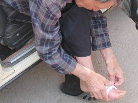 Жителю Ровенского района не могли ампутировать ногу с гангреной из-за отсутствия анестезиолога