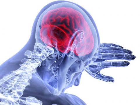 Саратовские ученые запатентовали способ более эффективно бороться с опухолями мозга