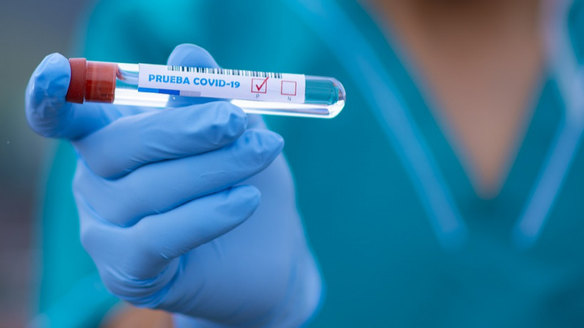 В Саратовской области за сутки выявили 65 новых случаев коронавируса, выписали 49 пациентов 