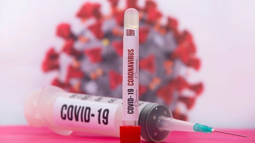 В Саратовской области еще почти сотня случаев COVID-19, три четверти - с пневмонией