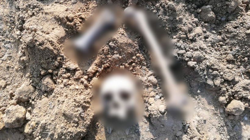 Вместе с землей рабочие привезли на Сокурский тракт человеческий череп и кость