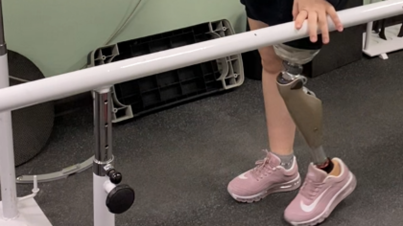 Юной спортсменке из Саратова, лишившейся ноги, изготовили протез. Девочка учится ходить на двух ногах