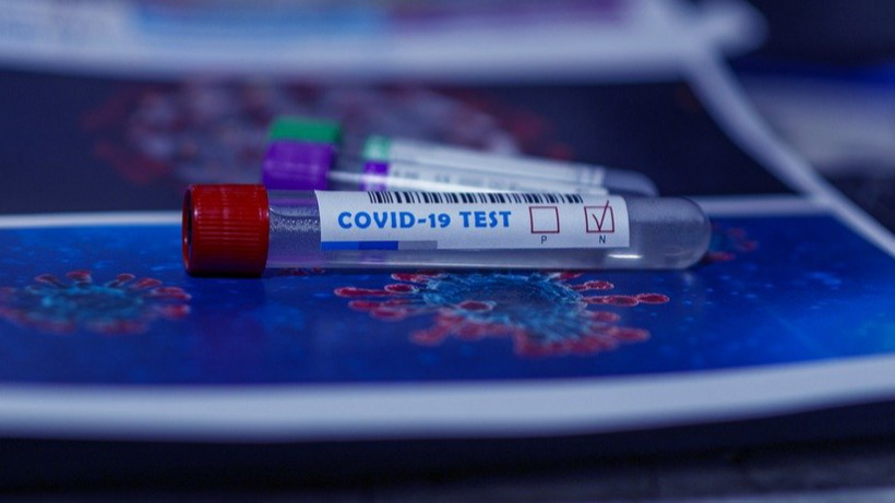 Саратовцам не будут делать бесплатных тестов на антитела к коронавирусу