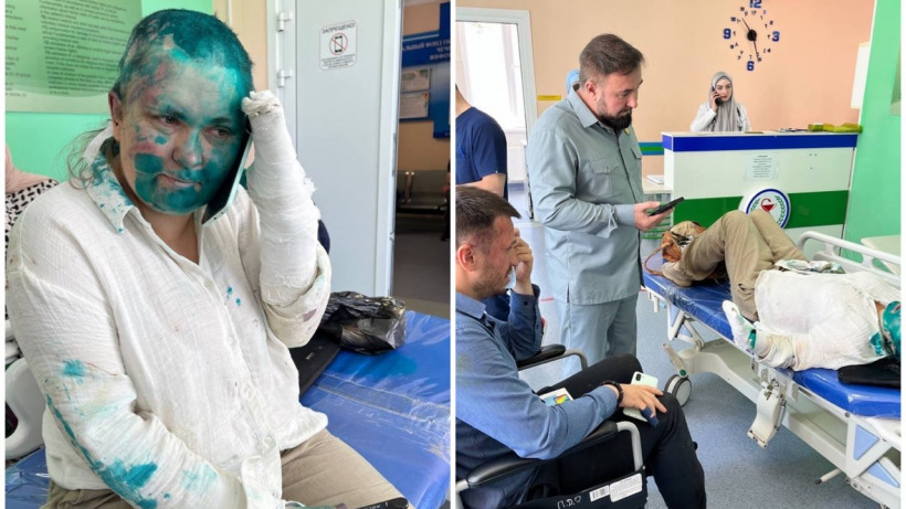 Обрили, избили, облили зеленкой. Правозащитник опубликовал фото Елены Милашиной, на которую совершено нападение в Чечне